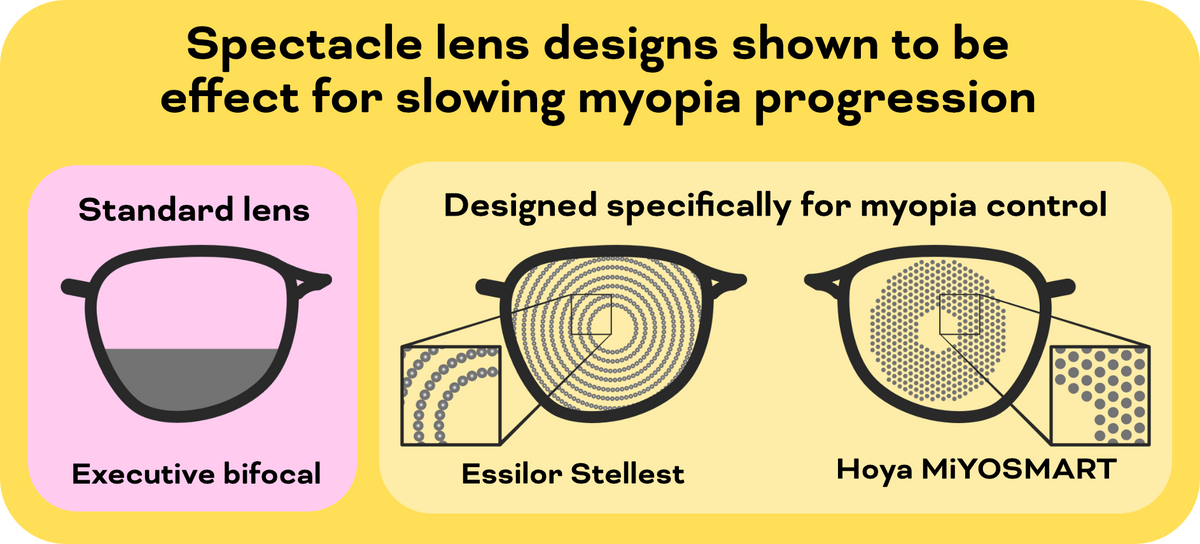 Understanding The Principles Of Myopia Glasses Tips For Wearing And C 3635